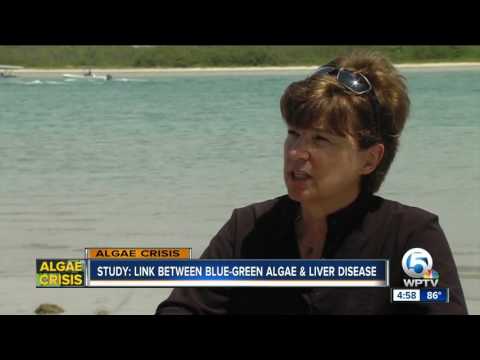 Study: Link between blue-green algae & liver disease