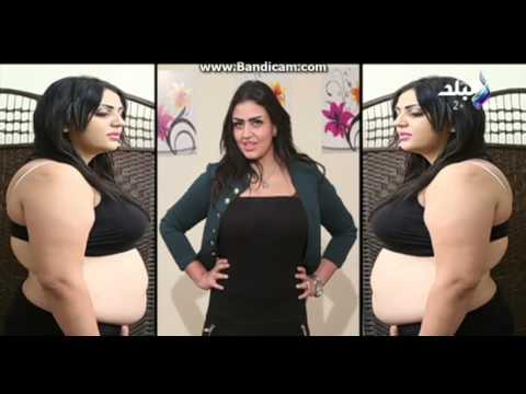 د  طارق رائف  تقرير عن حالة من حالات السمنة