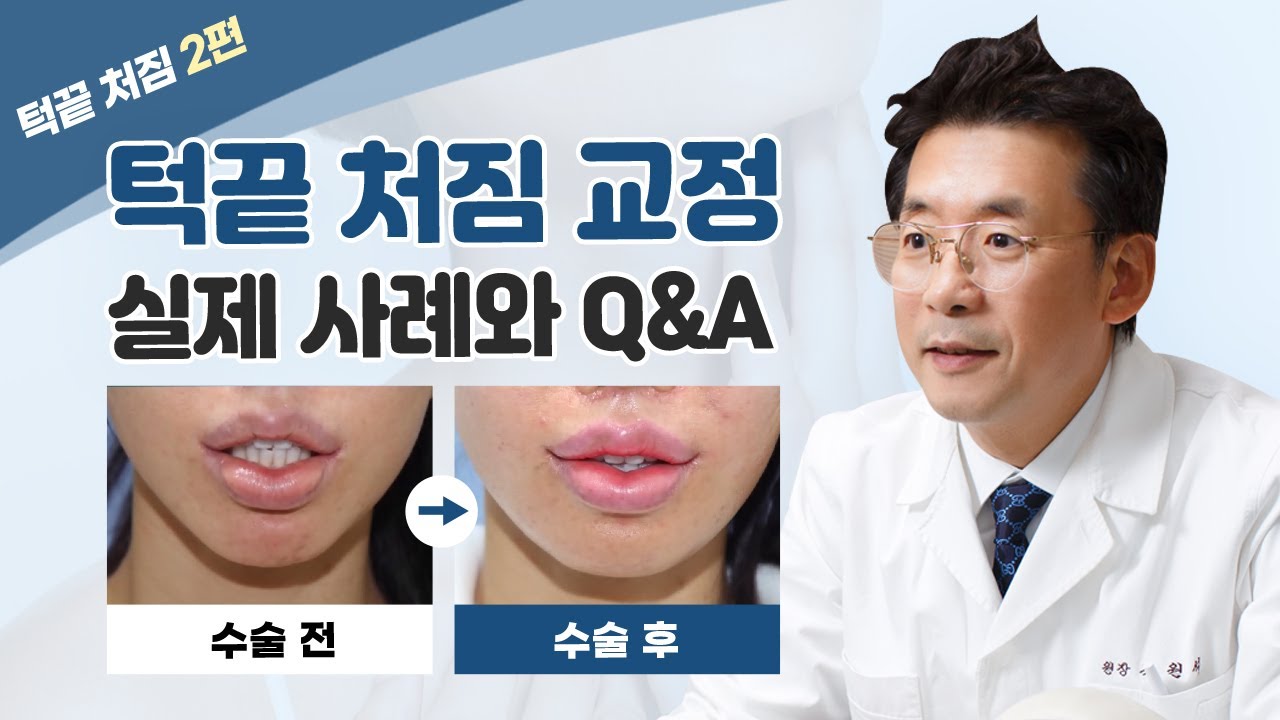 윤곽수술 후 앞턱 처침 등의 부작용과 개선할 수 있는 방법 2편✅ 썸네일