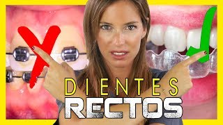 🔵¿como ARREGLAR los dientes 𝐒𝐈𝐍 𝐁𝐑𝐀𝐂𝐊𝐄𝐓𝐒🔵 Como funciona la ORTODONCIA INVISIBLE (👌FUNCIONA 👌)