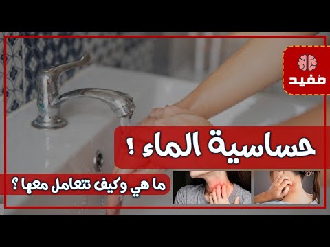 حساسية الماء وكيف نتعامل معها ؟