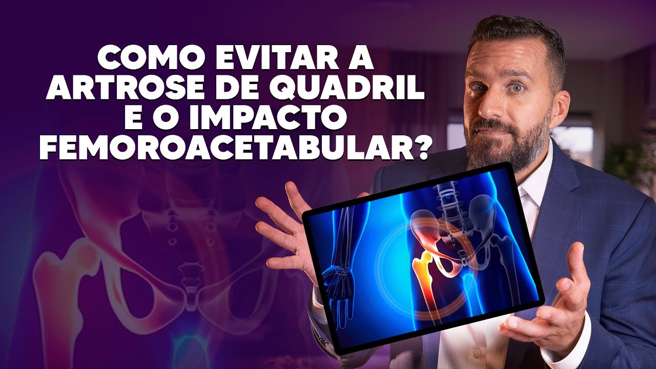 Como evitar a artrose de quadril e o impacto femoroacetabular?
