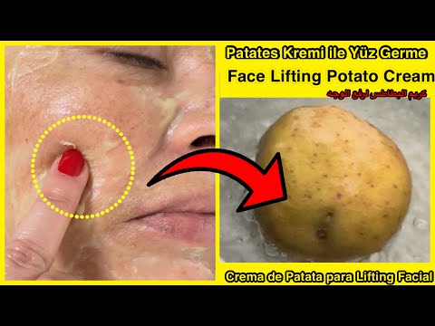 %100 Effective ✅!Mom Looks 10 Years Younger With Boiled POTATO Face CREAM ! FACE LIFTING-BLEMISH