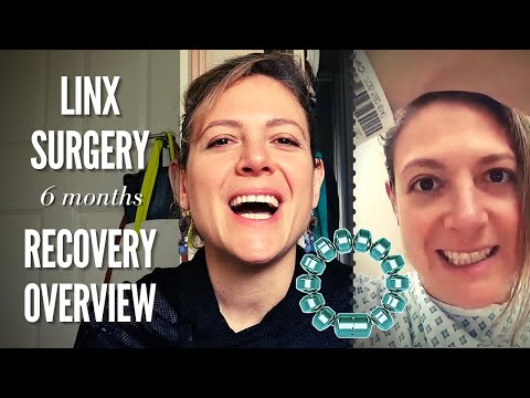 LINX Surgery - 6 Months Recovery Overview | SEE VIDEO UPDATE LINK ↓