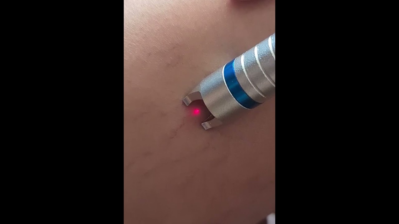 Deni Martínez Gama-26