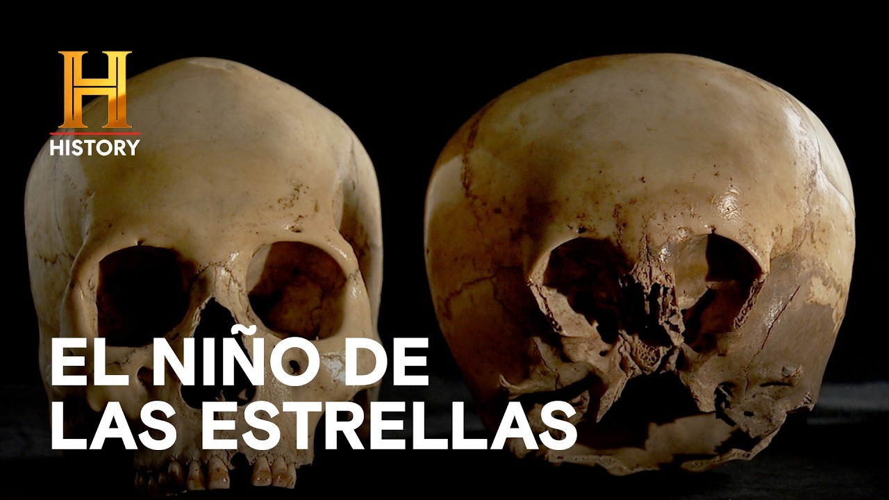EL NIÑO DE LAS ESTRELLAS: ¿Un cráneo humano o una prueba extraterrestre? - Monstruos Legendarios