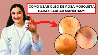 Como usar o óleo de Rosa Mosqueta para clarear manchas!