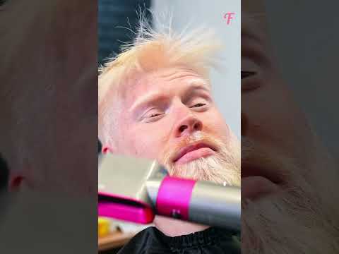Albino Transformation: Love at First Sight #shorts