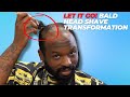 Let It Go Knowing When To Go Bald