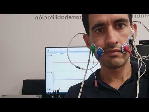 Facial palsy: EMG biofeedback system to retrain zigomaticus major muscle (smile)