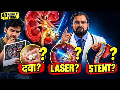 Kidney Stone FAQ | Treatment Questions in Hindi (10 सवाल)