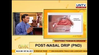 All about Post-nasal drip (PND) | Usapang Pangkalusugan