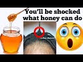 WOW 😳  REVERSE ALOPECIA & BALDING IMMEDIATELY FAST BY USING HONEY HAIR SPRAY! Honey For hair growth