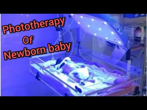 Thumbnail for Newborn Baby Jaundice |Neonatal Jaundice |Mechanism Of Phototherapy| Haemolytic jaundice | by Nlood