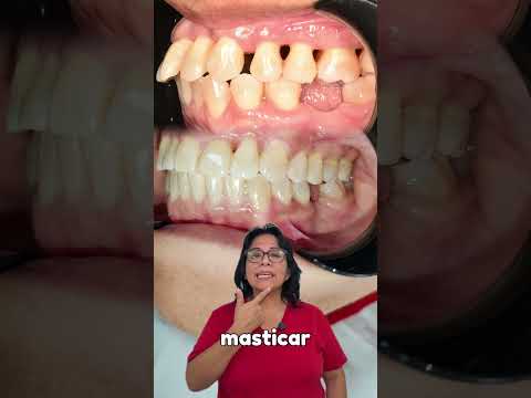 Video testimonial de ortodoncia en un paciente adulto