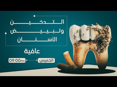 فيديو | التدخين وتبييض الأسنان… ما الذي يفسده الدخان وما الذي تصلحه التقنيات الحديثة؟ في عافية مع أسيل عماد