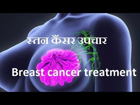 स्तन कैंसर के चौंकाने वाले फायदे /breast cancer treatment in ayurveda Video