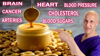 1 Tablespoon of Peanut Butter Daily...Your Blood Sugar, Cholesterol, Arteries & Heart Will Love You!
