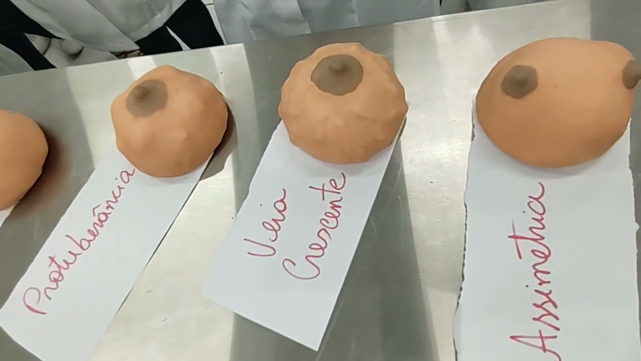 Auto-exame das mamas e sinais e sintomas de câncer de mama.