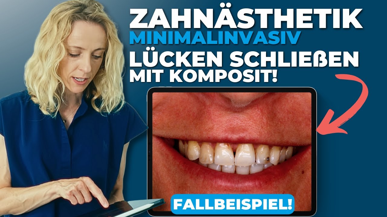 Video-Vorschaubild