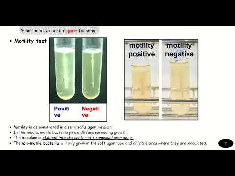 Gram positive bacilli lab