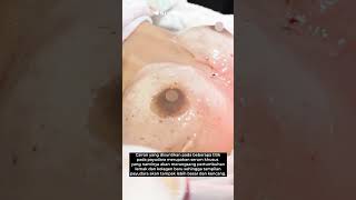 Download lagu Menambah Volume dan Kekencangan Payudara dengan Breast Enhancement || NOVI'S CLinic mp3 Download lagu Menambah Volume dan Kekencangan Payudara dengan Breast Enhancement || NOVI'S CLinic mp3