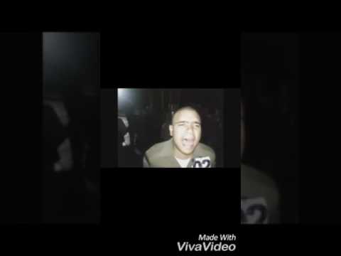 Quebrei o Braço !!!😨😷😷😵