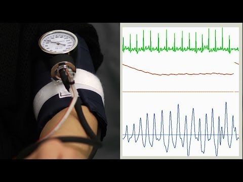 Zilch hypertonen Sprühführung Preis IRR im Gegensatz zu Bluthochdruck