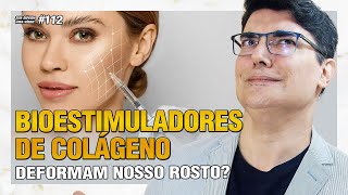 BIOESTIMULADORES DE COLÁGENO deformam nosso rosto? | Sua Dúvida Vira Vídeo #112