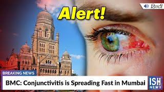 BMC: Conjunctivitis is Spreading Fast in Mumbai