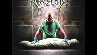 Rupture Christ - Gorged on Innards