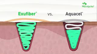 Product video: Exufiber Ag+ Antimicrobial Gelling Fiber Dressing