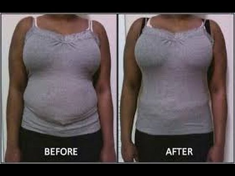 comment faire si j'ai oublié de prendre ma pilule