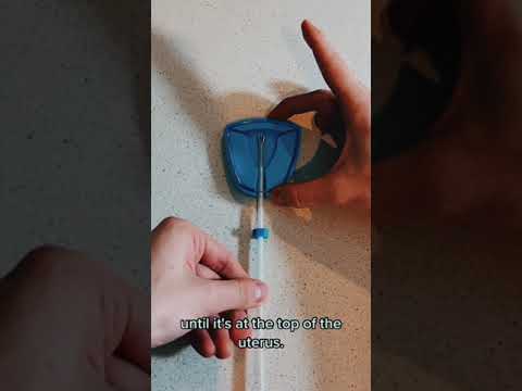 IUD Insertion & IUD Removal (Copper Paragard, Mirena) (Part 2)