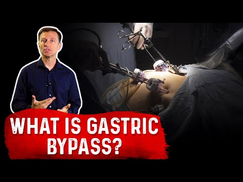 6 Common Myths About Weight Loss Pills – Dr Berg