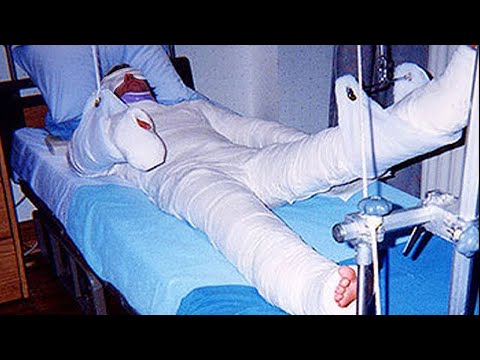 r/Storiesaboutkevin Idiot Broke All His Bones