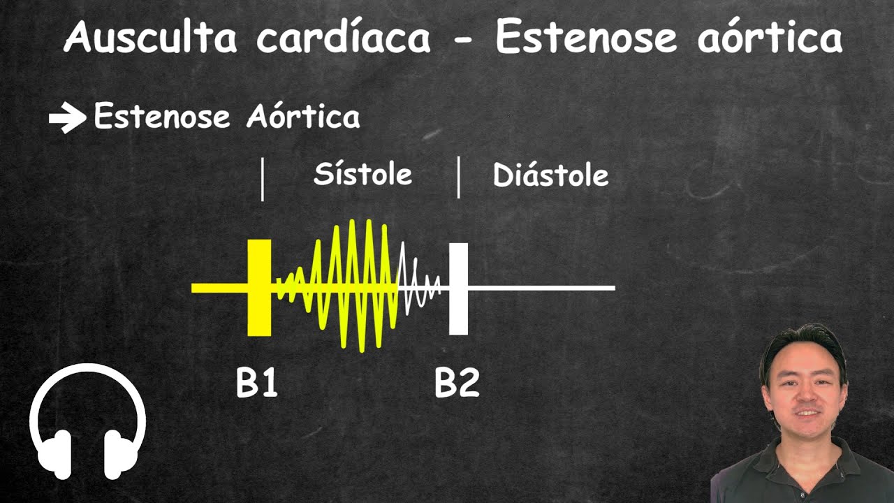 Ausculta cardiaca estenose aortica e insuficiencia aortica