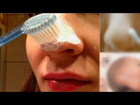 Das antifungale Präparat für die Nägel mikosan Von gribka des Nagels mikosan der Preis