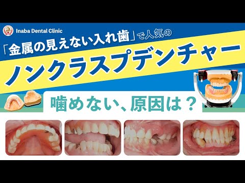 ノンクラスプデンチャー 〜噛めない、原因は？〜