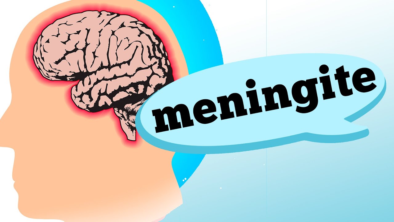 MENINGITE: Quais os sintomas? Como tratar?