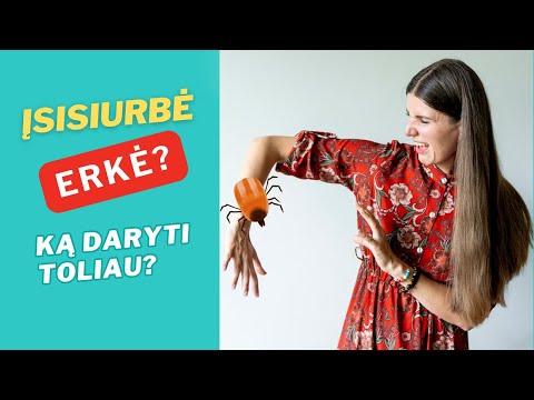 Įsisiurbė erkė? Ką DARYTI ir kaip PASIRUOŠTI