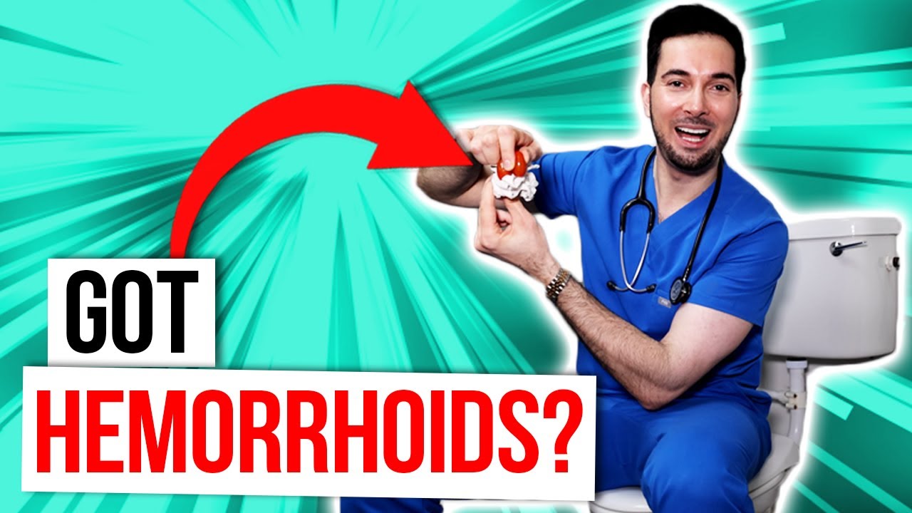 How to get rid of external prolapse hemorrhoids at home? Tipseri