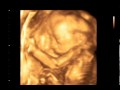 3D/4D УЗИ 21 неделя (3D/4D Ultrasound scan baby 21 Weeks ...