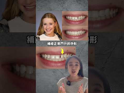 門牙大小