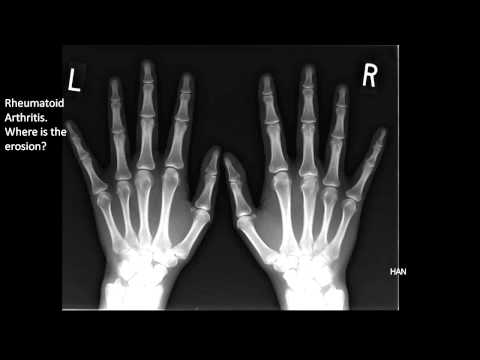 Il rilassamento postisometric del rachide cervicale Dolore nel basso addome e parte bassa della schiena nelle donne