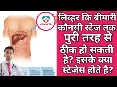 Liver Disease:- Stages & Recovery। लिव्हर कि बीमारी कौनसी स्टेज तक ठीक हो सकती है?