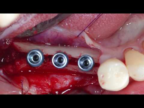 download lagu mp3 mp4 Smarthor, download mp3 Smarthor free download, download mp3 Smarthor