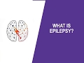 Accommodation Tips To Support Job Seekers With Epilepsy Their Caregivers Spouses In The Workplace