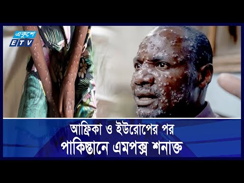 ভয়ংকর এমপক্স! আফ্রিকা-সুইডেনের পর ভয় ধরাতে এবার পাকিস্তানে | Ekushey ETV