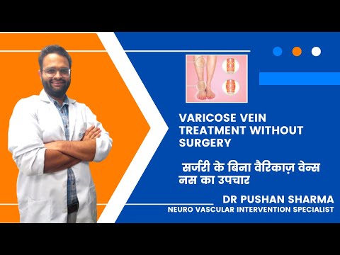 Varicose vein treatment without surgery| Dr. Pushan Sharma 